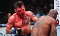 23 шва и два перелома. 40-летний боец показал последствия боя на турнире UFC 300