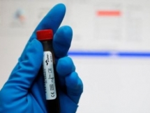 ВАДА лишило аккредитации антидопинговую лабораторию в Алматы