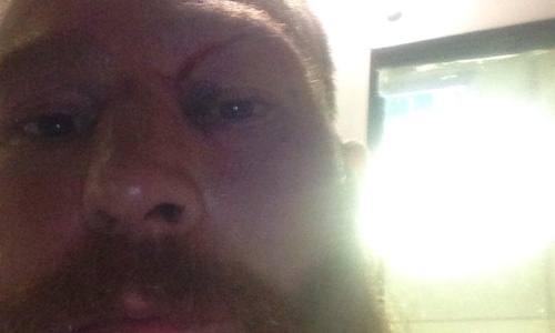 Несостоявшийся соперник Елеусинова засветил сорвавшую бой сечку 