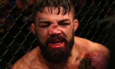 Боец UFC получил коленом по носу. Адское фото его травмы стало хитом в интернете