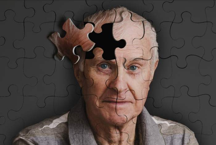 Назван ранний признак болезни Альцгеймера