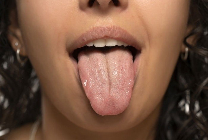 Сухость во рту может быть тревожным признаком пяти серьёзных заболеваний
