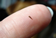 Как вытащить занозу — врач поделился лайфхаком