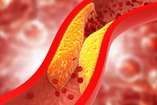 Сырой продукт — и холестерин в норме даже в 90 лет. Статины станут больше не нужны — настоящая панацея для организма