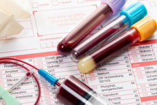 «Не тянуть драгоценное время». Назван быстрый и дешевый анализ, который поможет найти рак задолго до появления первых симптомов