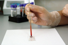 По простому анализу крови можно предсказать продолжительность жизни — сенсация от гематологов