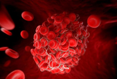 Растворяет тромбы лучше любых лекарств. Эта знакомая еда защитит от опасных недугов — рекомендация врача-флеболога