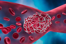 Врачи назвали три продукта против густой крови — они очистят организм от шлаков и токсинов