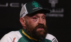 Бетербиев высказался о завершении карьеры Фьюри