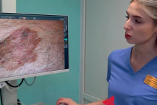 Онкологи объяснили, чем раковая родинка отличается от обычной — разница видна с первого взгляда