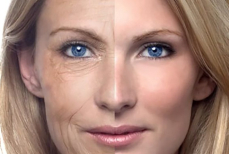 Семь продуктов, из-за которых вы выглядите старше