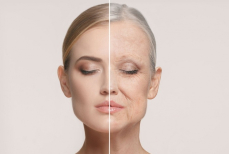 Прорыв в борьбе со старением. Учёные нашли новый способ остановить появление морщин