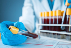 Как часто нужно сдавать кровь на общий анализ