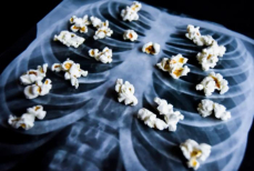 Попкорновая болезнь. Как вейпы превращают легкие в сухожилия