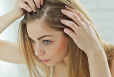 Как избавиться от перхоти в домашних условиях. Средства, советы, лайфхаки