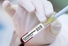 Минздрав прокомментировал ситуацию с COVID-19 в Казахстане