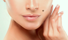 Родинка на удачу — как особые метки на теле предсказывают богатство и успех