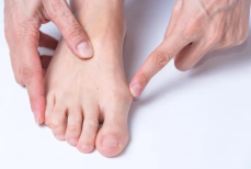 Эти пять простых упражнений помогут убрать косточку на большом пальце