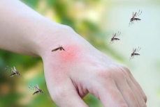 Комары и мошки летом — советы дерматолога, как защититься и что делать при укусах