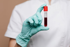 Медики назвали признаки, указывающие на очень жидкую кровь — почему это опасно