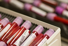 Названа группа крови, при которой риск рака значительно ниже