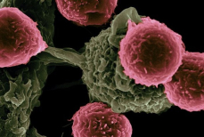 Ученые назвали вызывающую один из самых смертоносных видов рака привычку