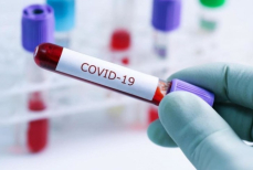 Неожиданные последствия COVID-19 — что находят у переболевших в Казахстане