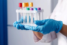 Что нельзя делать перед сдачей различных анализов