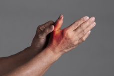 Назван способ выявить опасную патологию с помощью одного жеста