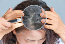 Можно ли остановить раннее поседение волос