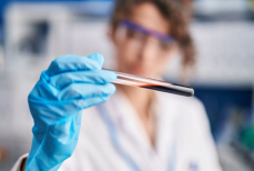 Названы симптомы, которые указывают на болезни крови