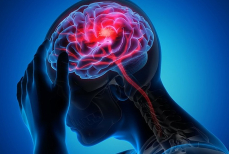 Невролог раскрыл неожиданный признак инсульта