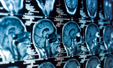 Жизнь в одиночестве оказалась токсичной для мозга