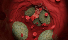 Назван неожиданный фактор повреждения артерий