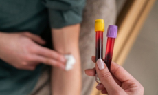 Как правильно сдавать анализов крови