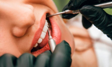 Чем вредны домашние методы исправления прикуса