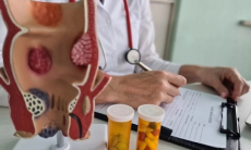 Развеяны главные мифы о геморрое