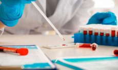 Как тревожность может повлиять на результаты анализов крови