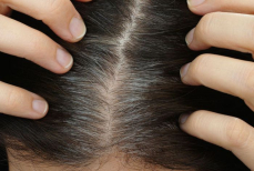 Найдена связь между поседением волос и риском рака кожи