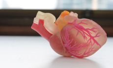 Почему болезни сердца «молодеют»