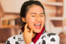 Можно ли заболеть ветрянкой повторно — объяснение врача