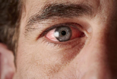 Врач объяснил, почему у пожилых слезятся глаза