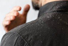 Миф или правда — заразна ли перхоть