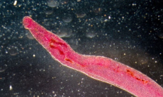 Поражение мозга и смерть. Какие паразиты опасны для человек