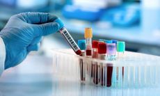 В крови переболевших COVID-19 выявили необычные изменения