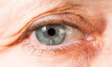 Дефицит двух веществ связали с развитием нарушения зрения