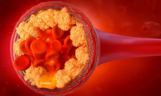 У снижения уровня «плохого» холестерина нашли опасность для здоровья