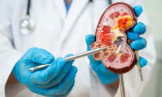 Из-за каких продуктов появляются камни в почках