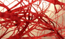 Три признака проблем с сосудами сердца, шеи и мозга