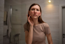 Названы проблемы с кожей и волосами, которые возникают из-за стресса